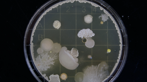 Petri dish growing mold, mold removal, and mold remediation.